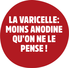 La varicelle: moins anodine qu’on ne le pense !